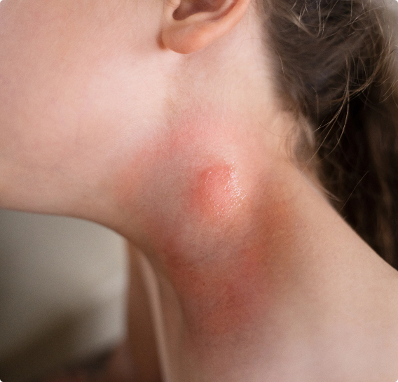 Woman with injury neck