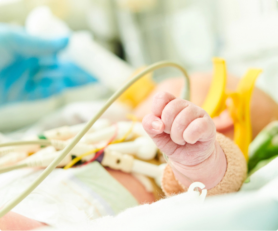 Baby doing treatment